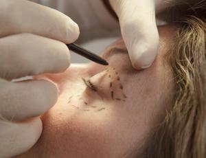 eye pen marking